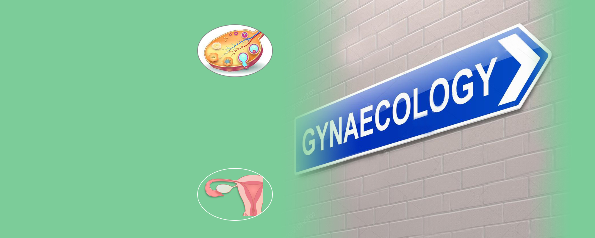 Gynaecologist  Greater Noida